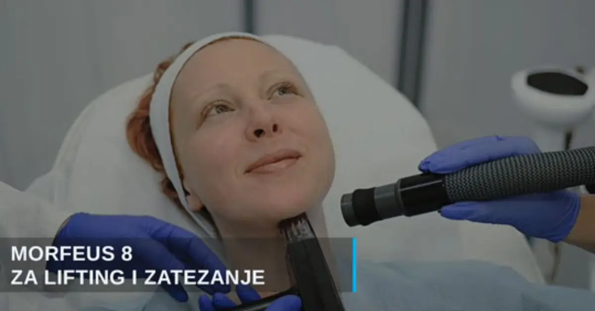 Morfeus 8 nehirurški lifting lica i vrata i podmlađivanje u poliklinici Diva dr Bogdanović - dermatologija antiaging zatezanje