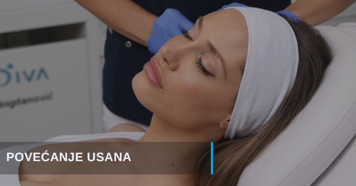 Povećanje usana dermalnim filerima poliklinika Diva dr Bogdanović