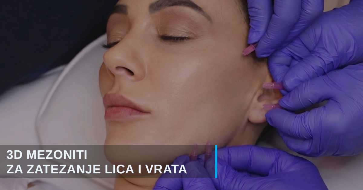 3D mezoniti - neoperativni lifting lica