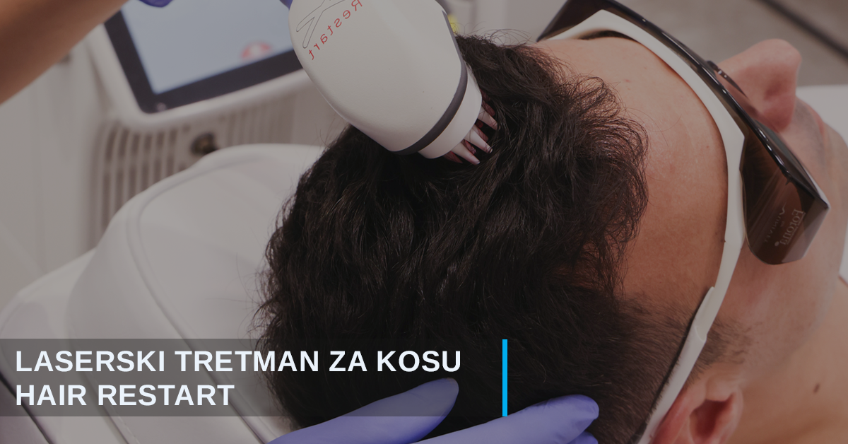 Hair Restart laserski tretman za kosu u Beogradu