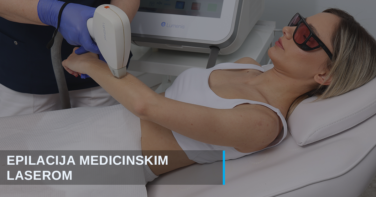Epilacija medicinskim laserima
