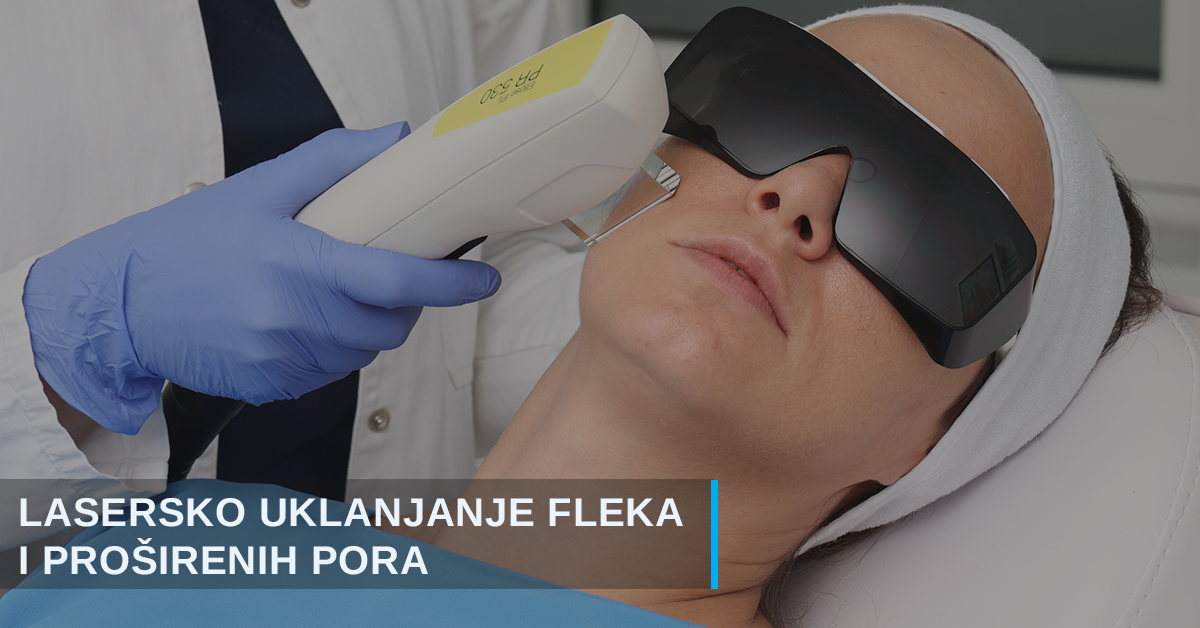 Lasersko uklanjanje fleka i tretman proširenih pora