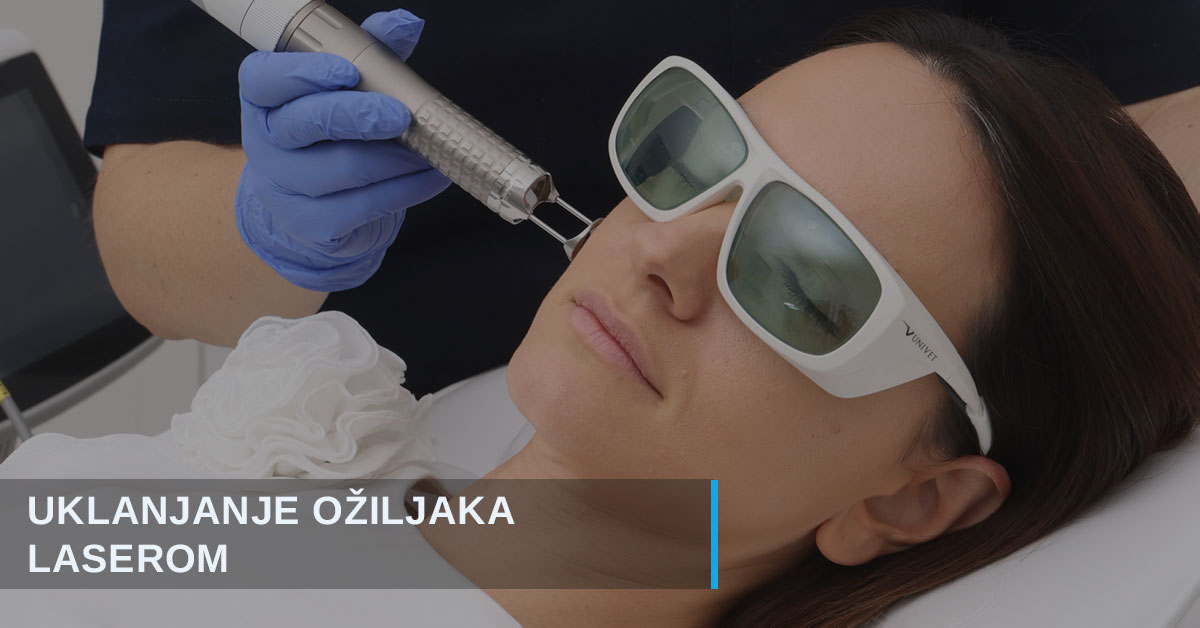 Uklanjanje ožiljaka laserom u Beogradu
