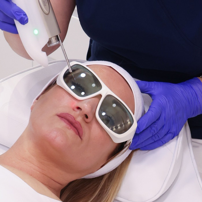Uklanjanje ožiljaka laserom u Beogradu
