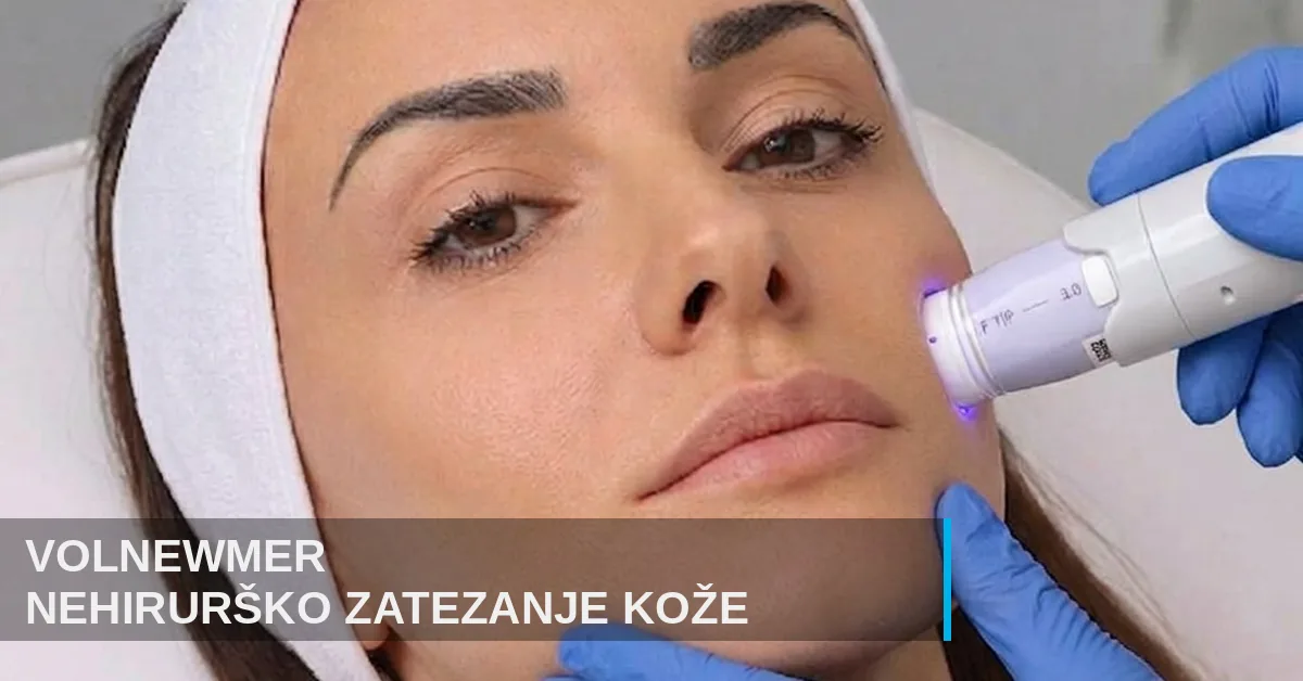 Volnewmer radiotalasni lifting lica bez operacije u poliklinici Diva dr Bogdanović Beograd