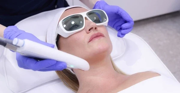 Kako izgleda lasersko podmlađivanje TwinLight laserom u poliklinici Diva