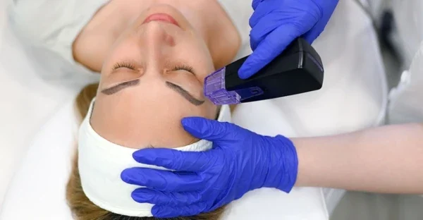 Nehirurško zatezanje kože lica i vrata Morfeus 8 poliklinika Diva dr Bogdanović Beograd